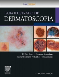 Baixar Guia Ilustrado de Dermatoscopia, 2&ordf; Edi&ccedil;&atilde;o pdf, epub, eBook