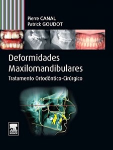 Baixar Deformidades Maxilomandibulares pdf, epub, eBook