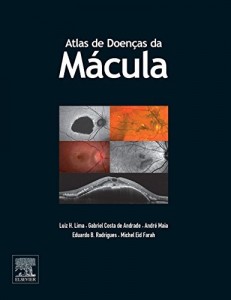 Baixar Atlas de Doen&ccedil;as da Macula pdf, epub, eBook