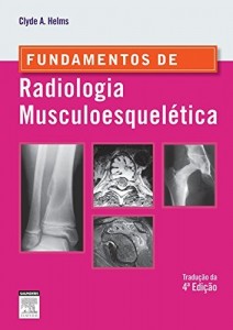 Baixar Fundamentos de Radiologia Musculoesquel&eacute;tica – 4&ordf; Edi&ccedil;&atilde;o pdf, epub, eBook