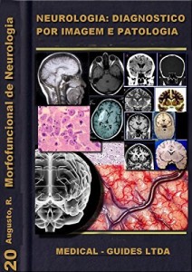 Baixar Neurologia: Diagn&oacute;stico por Imagem (Guias m&eacute;dicos Livro 2) pdf, epub, eBook