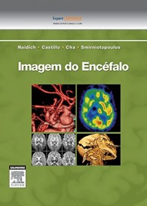Baixar Imagem do Encefalo pdf, epub, eBook