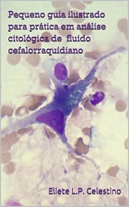 Baixar Pequeno guia ilustrado para pr&aacute;tica em an&aacute;lise citol&oacute;gica de fluido cefalorraquidiano pdf, epub, eBook
