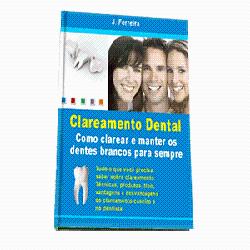 Baixar Clareamento Dental pdf, epub, eBook
