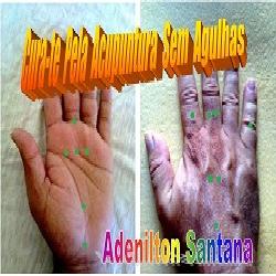 Baixar CURA-TE PELA ACUPUNTURA SEM AGULHAS pdf, epub, eBook