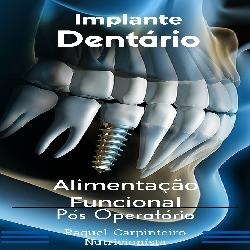 Baixar Implante Dentário Alimentação Funcional No Pós Operatório pdf, epub, eBook