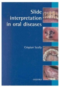 Baixar Slide interpretation in oral disease pdf, epub, eBook