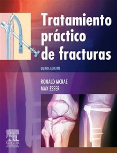Baixar Tratamiento practico de fracturas pdf, epub, eBook