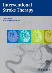 Baixar Interventional stroke therapy pdf, epub, eBook