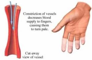 Baixar Informative guide about buerger’s disease, an pdf, epub, eBook