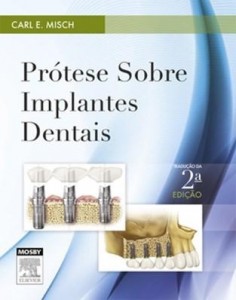 Baixar Protese sobre implantes 2ª edição pdf, epub, eBook