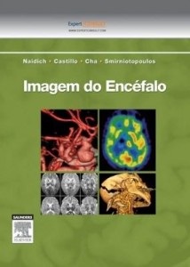 Baixar Imagem do encefalo pdf, epub, eBook