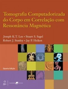 Baixar Tomografia Computadorizada do Corpo em Correlação com Ressonância Magnética pdf, epub, eBook