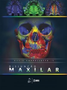 Baixar Disjunção Maxilar pdf, epub, eBook