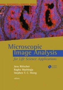 Baixar Particle Tracking in 3D+t Biological Imaging: Chapter 10 from Microscopic Image Analysis for Life Sc pdf, epub, eBook