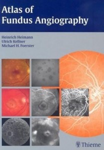 Baixar Atlas of Fundus Angiography pdf, epub, eBook