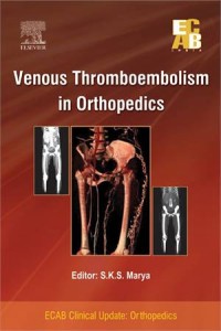 Baixar Venous thromboembolism in orthopedics – ecab pdf, epub, eBook