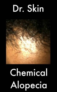 Baixar Chemical alopecia pdf, epub, eBook