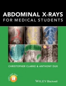 Baixar Abdominal X-rays for Medical Students pdf, epub, eBook