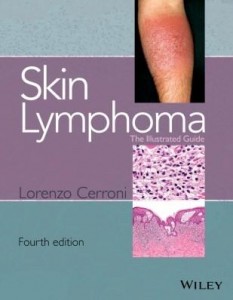 Baixar Skin Lymphoma pdf, epub, eBook
