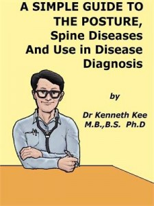 Baixar Simple guide to the posture, spine diseases pdf, epub, eBook