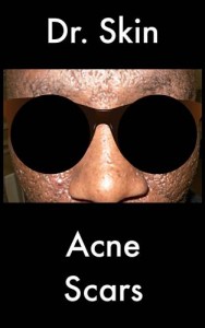 Baixar Acne scars pdf, epub, eBook