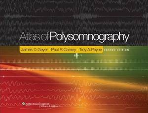 Baixar Atlas of polysomnography pdf, epub, eBook