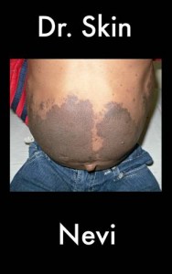 Baixar Nevi pdf, epub, eBook