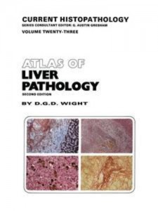 Baixar Atlas of liver pathology pdf, epub, eBook