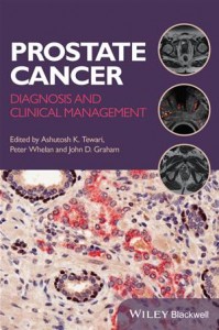Baixar Prostate cancer pdf, epub, eBook