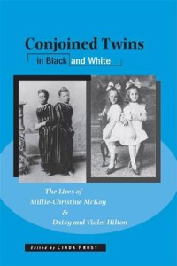 Baixar Conjoined twins in black and white: the lives of pdf, epub, eBook
