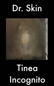 Baixar Tinea incognito pdf, epub, eBook