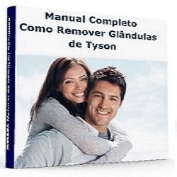 Baixar Guia Como Remover GT pdf, epub, eBook