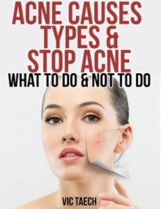 Baixar Acne causes types & stop acne: what to do & not pdf, epub, eBook