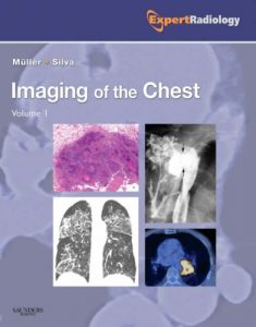 Baixar Imaging of the chest pdf, epub, eBook