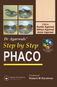 Baixar Phaco : step by step pdf, epub, eBook